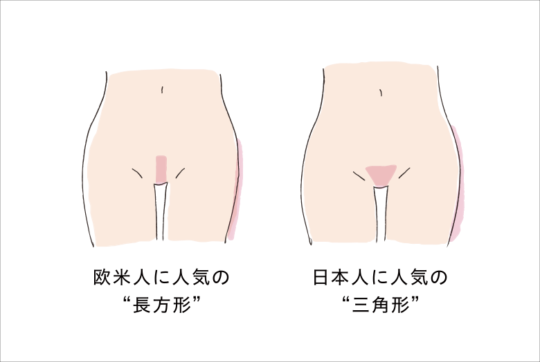 欧米人に人気な「長方形」、 日本人に人気な「三角形」